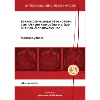 Získané demyelinizačné ochorenia centrálneho nervového systému-diferenciálna diagnostika