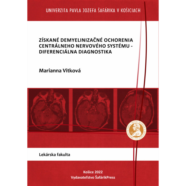 Získané demyelinizačné ochorenia centrálneho nervového systému-diferenciálna diagnostika