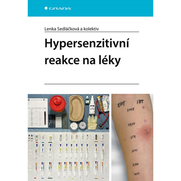 Hypersenzitivní reakce na léky