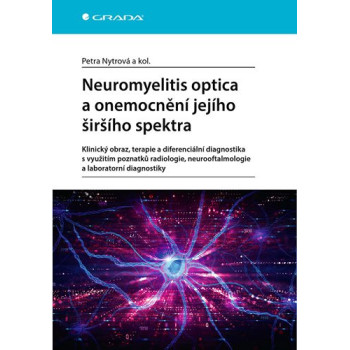 Neuromyelitis optica a poruchy jejího širšího spektra