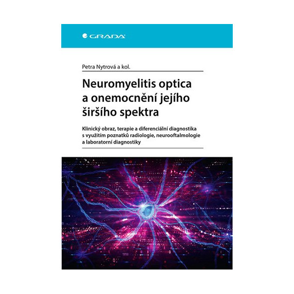 Neuromyelitis optica a poruchy jejího širšího spektra