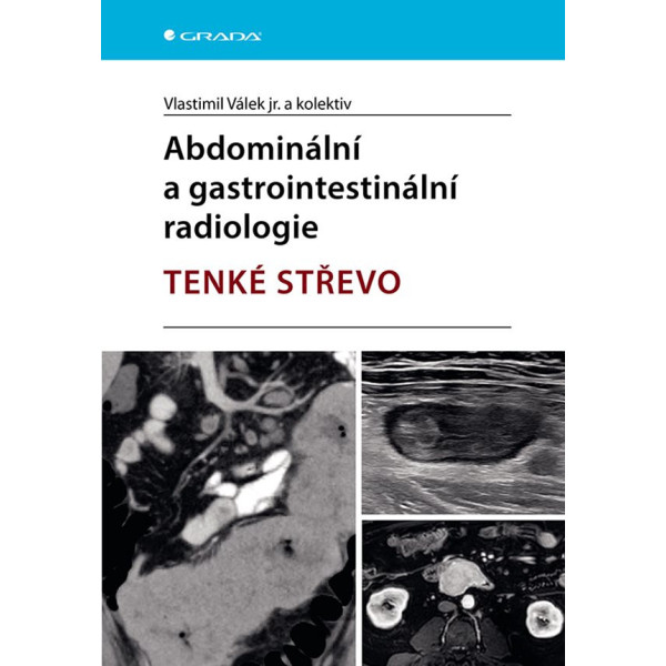 Abdominální a gastrointestinální radiologie - tenké střevo