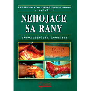 Nehojace sa rany
