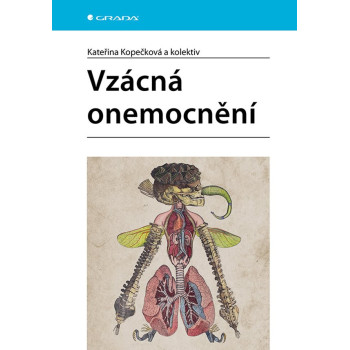 Vzácná onemocnění