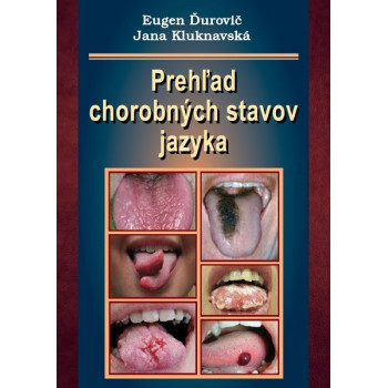 Prehľad chorobných stavov jazyka
