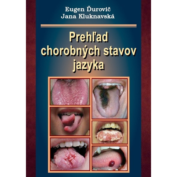 Prehľad chorobných stavov jazyka