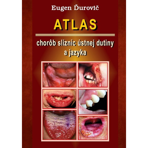 Atlas chorôb slizníc ústnej dutiny a jazyka
