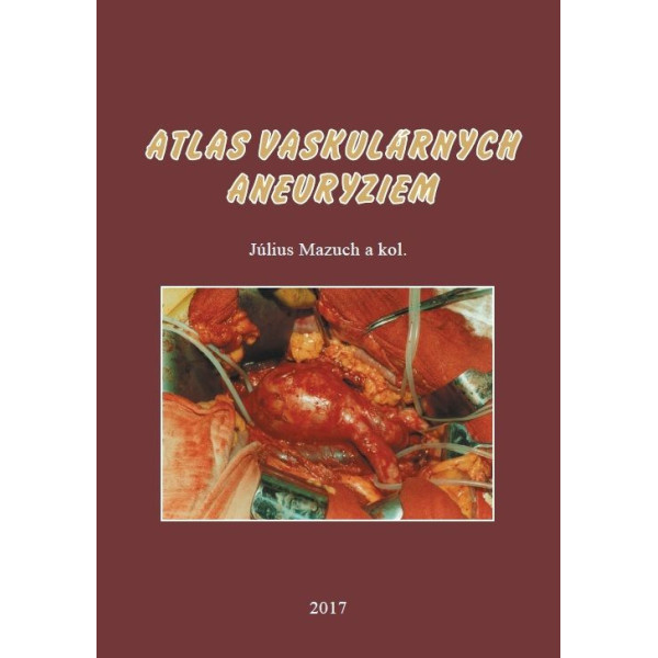 Atlas vaskulárnych aneuryziem