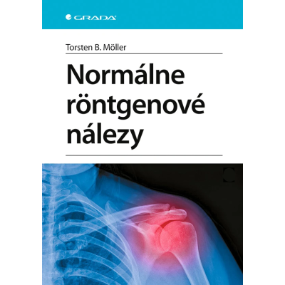 Normálne röntgenové nálezy