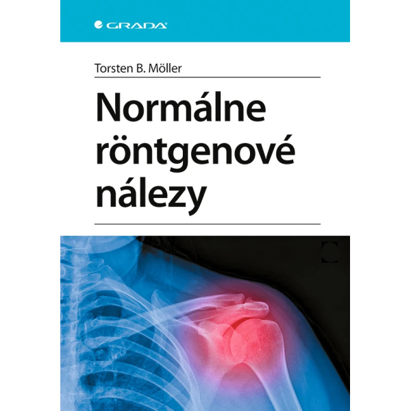 Normálne röntgenové nálezy