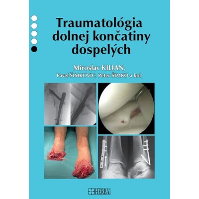 Traumatológia dolnej končatiny dospelých