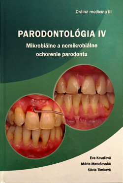 Parodontológia IV