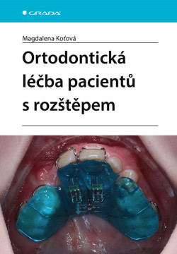 Ortodontická léčba pacientů s rožtěpem