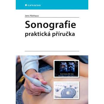 Sonografie