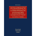 Intraoperační a perioperační endoskopie