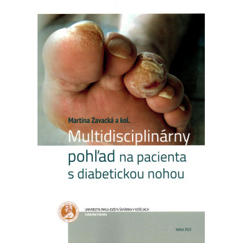 Multidisciplinárny pohľad na pacienta s diabetickou nohou