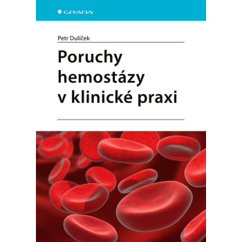 Poruchy hemostázy v klinické praxi