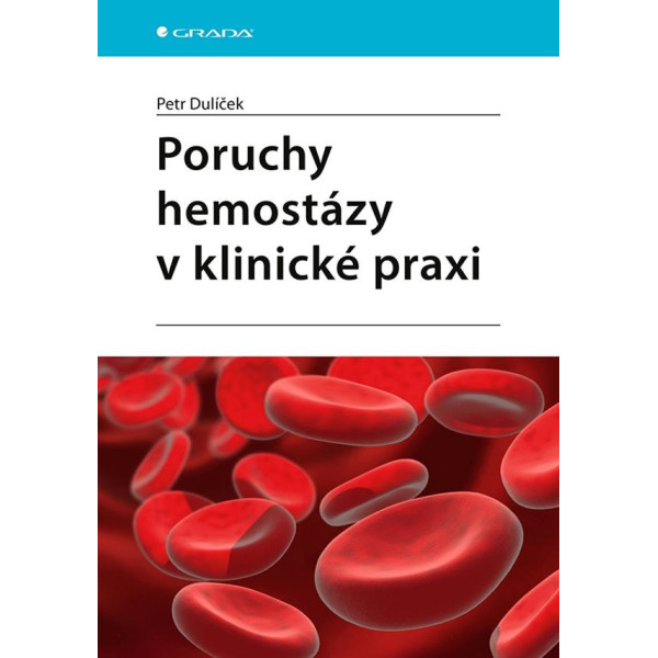 Poruchy hemostázy v klinické praxi