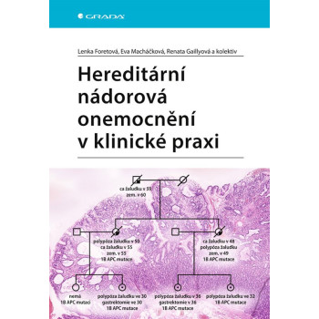 Hereditární nádorová onemocnění v klinické praxi