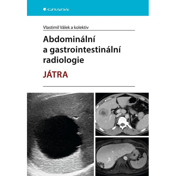 Abdominální a gastrointestinální radiologie