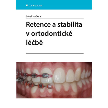 Retence a stabilita v ortodontické léčbě