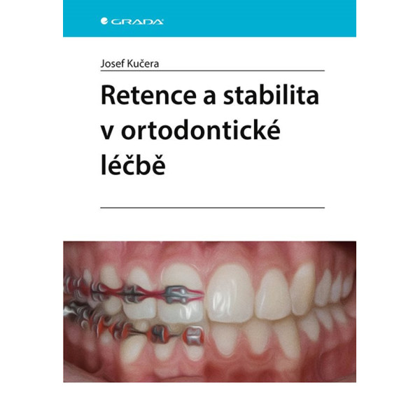 Retence a stabilita v ortodontické léčbě