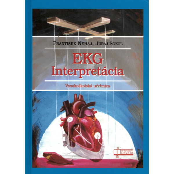 EKG - Interpretácia