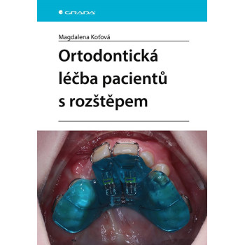 Ortodontická léčba pacientů s rožtěpem