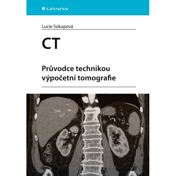 CT - Průvodce technikou výpočetní tomografie