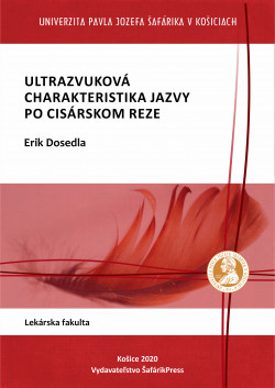 Ultrazvuková charakteristika jazvy po cisárskom reze