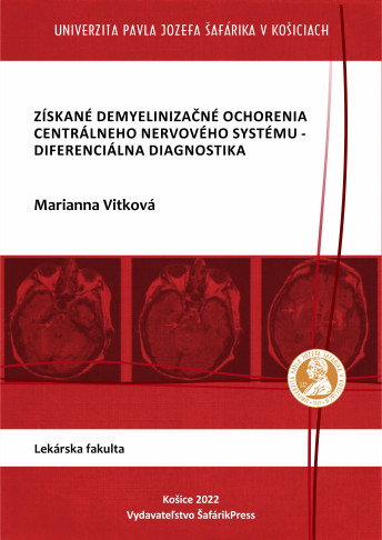 Získané demyelinizačné ochorenia centrálneho nervového systému-diferenciálna diagnostika